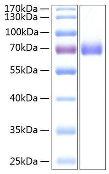 Recombinant Human EphA2/ECK Protein (RPCB0210)