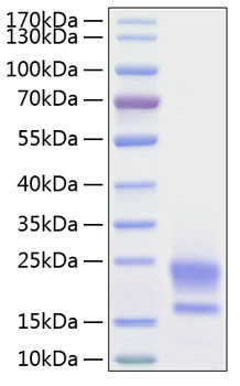 Recombinant Human WAP5/WFDC2/HE4 Protein (RPCB0216)