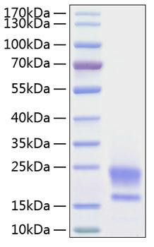 Recombinant Human WAP5/WFDC2/HE4 Protein (RPCB0216)