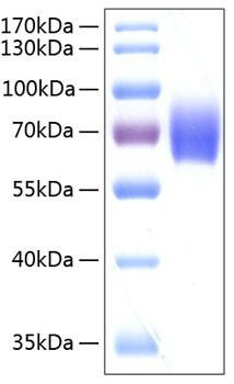 Recombinant Human Serpin F2/Alpha-2-antiplasmin Protein (RPCB0237)