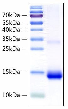 Recombinant Human Cystatin-SN/CST1 Protein (RPCB0238)