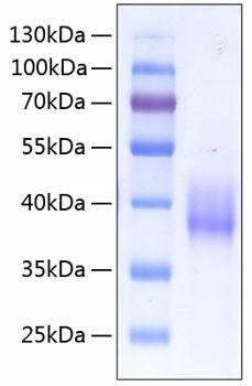 Recombinant Human Coagulation factor III/Tissue factor/CD142 Protein (RPCB0251)