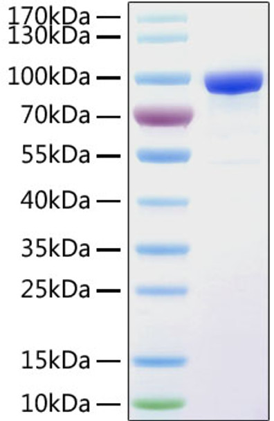 Recombinant Human sTfR/CD71 Protein (RPCB0254)