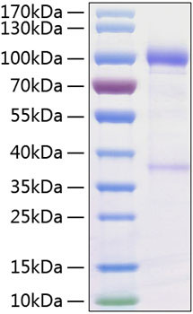 Recombinant Human GDNFR-alpha-1/GFRA1 Protein (RPCB0258)