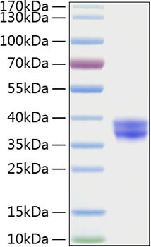 Recombinant Human Cell surface A33 antigen/GPA33 Protein (RPCB0262)