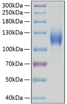 Recombinant Human c-Kit/CD117 Protein (RPCB0265)