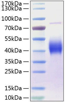 Recombinant Human B7-1/CD80 Protein (RPCB0269)