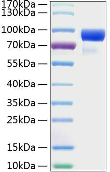 Recombinant Human Hedgehog-interacting protein/HHIP Protein (RPCB0289)