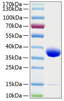 Recombinant Human Prolactin receptor/PRL-R Protein (RPCB0294)