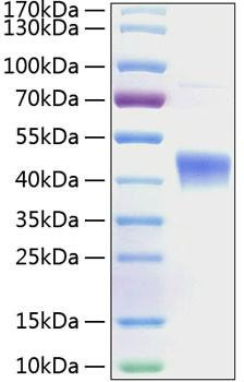 Recombinant Human IL-22RA2/IL22BP Protein (RPCB0308)
