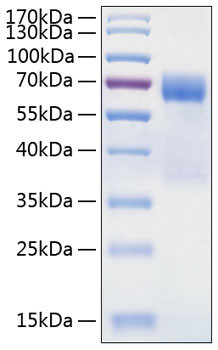 Recombinant Human TIM-3/HAVCR2/CD366 Protein (RPCB0318)