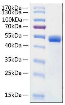 Recombinant Human Cathepsin D Protein (RPCB0323)