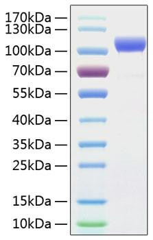 Recombinant Human ErbB-2/HER2/CD340 Protein (RPCB0331)