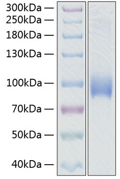 Recombinant Human L-Selectin/SELL/CD62L Protein (RPCB0338)