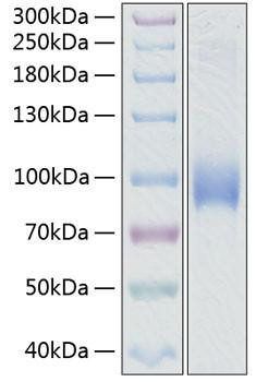 Recombinant Human L-Selectin/SELL/CD62L Protein (RPCB0338)