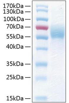 Recombinant Human THSD1 Protein (RPCB0347)