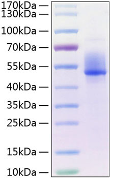 Recombinant Human Dkk-3 Protein (RPCB0361)