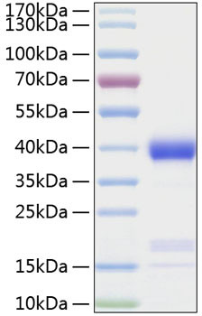 Recombinant Human Azurocidin/CAP37/AZU1 Protein (RPCB0367)