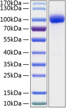 Recombinant Human IL-1R2/CD121b Protein (RPCB0370)