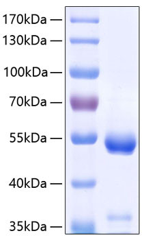 Recombinant Human Carboxypeptidase E/CPE Protein (RPCB0372)