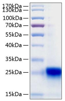 Recombinant Human IFN-lambda 3/IL-28B Protein (RPCB0378)