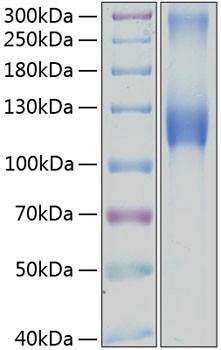 Recombinant Human Osteoactivin/GPNMB Protein (RPCB0382)