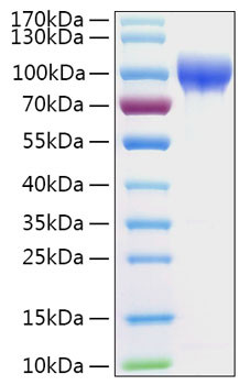 Recombinant Human Serpin G1/Plasma protease C1 inhibitor Protein (RPCB0397)