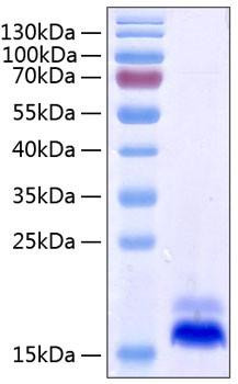 Recombinant Human TNFRSF10B/DR5/TRAIL-R2/CD262 Protein (RPCB0398)