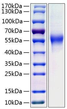 Recombinant Human CD46 Protein (RPCB0401)