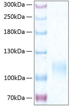 Recombinant Human E-selectin/SELE/CD62E Protein (RPCB0404)