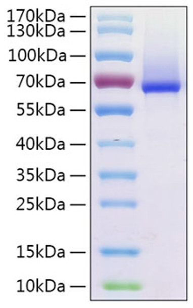 Recombinant Human Glypican-1/GPC1 Protein (RPCB0408)