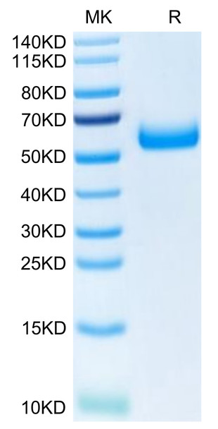 Recombinant Human TREM2 Protein (RPCB0413)