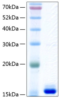 Recombinant Human Transthyretin/TTR Protein (RPCB0415)
