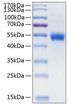 Recombinant Human Lumican/LUM Protein (RPCB0421)