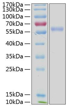 Recombinant Human NKG2D ligand 3/ULBP3 Protein (RPCB0422)