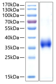 Recombinant Human CD2 Protein (RPCB0429)