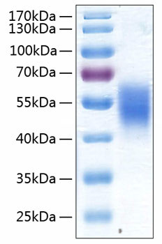 Recombinant Human ALK-7/ACVR1C Protein (RPCB0438)