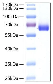 Recombinant Human BTN1A1/Butyrophilin Protein (RPCB0472)