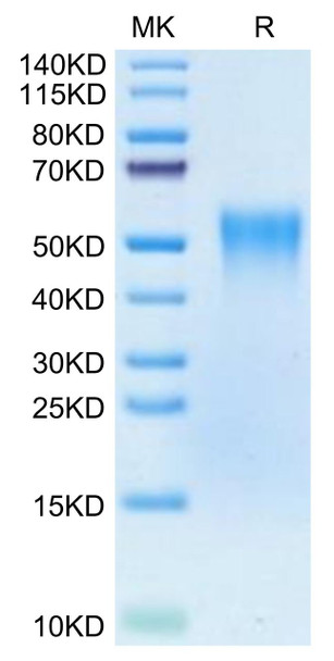 Biotinylated Recombinant Human TNFRSF1B/TNF-R2/CD120b Protein (Primary Amine Labeling) (RPCB0483)