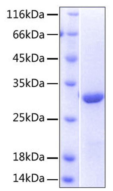Recombinant Human NKG2-D/KLRK1/CD314 Protein (RPCB0485)