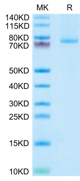 Recombinant Human TNFSF9/4-1BB Ligand Trimer Protein (RPCB0507)