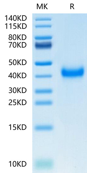 Recombinant Human KLRB1/CD161 Protein (RPCB0510)