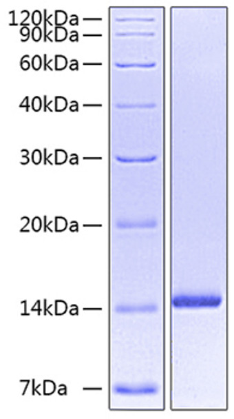 Recombinant Human Neurotrophin-3/NGF-2/NT-3 Protein (RPCB0520)