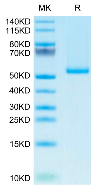 Recombinant Human TNFSF9/4-1BB Ligand Trimer Protein (RPCB0537)