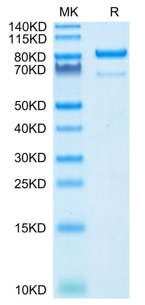 Recombinant Human 5'-Nucleotidase/NT5E/CD73 Protein (RPCB0554)