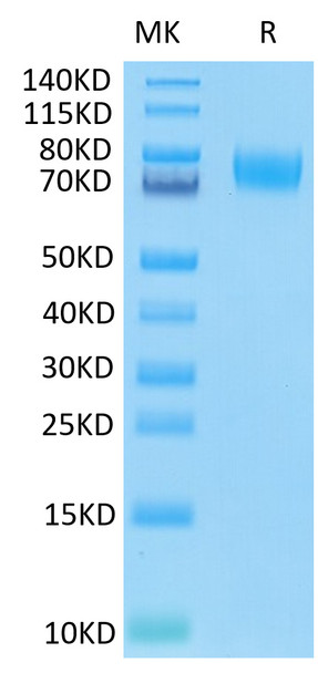 Recombinant Human B7-H3 (4Ig)/B7-H3b/CD276 Protein (RPCB0581)