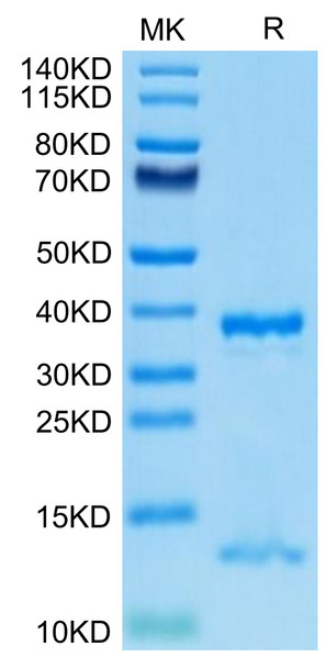 Recombinant Human FcRn/FCGRT&B2M Protein (RPCB0614)