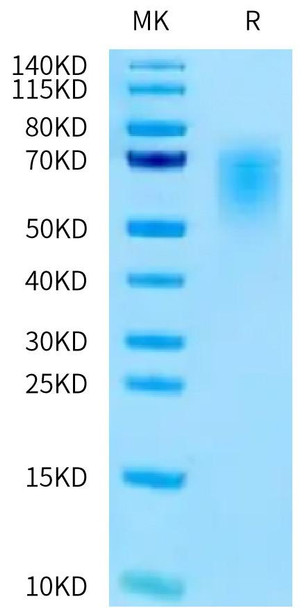 Recombinant Human CEACAM5/CEA/CD66e (145-322) Protein (RPCB0618)