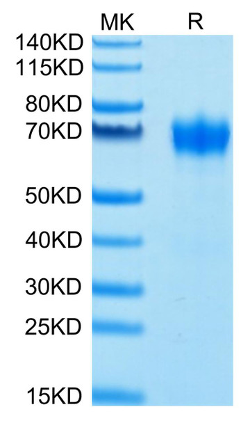 Biotinylated Recombinant Human CSF2RA/GM-CSF R alpha/CD116 Protein (RPCB0632)