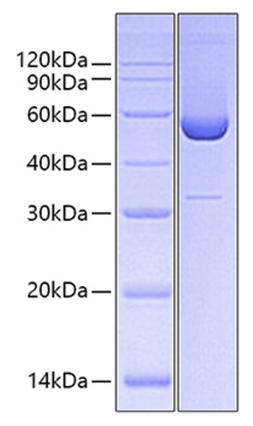 Recombinant Human Serpin H1/HSP47 Protein (RPCB0647)